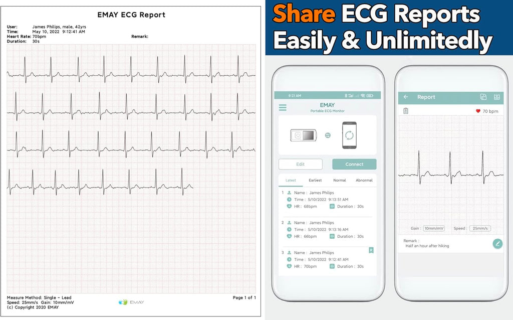 Portable ECG Monitor (Grey) G569